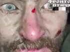 Жуткое видео допроса пленного ВСУшника-наркомана показали наши военкоры