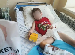 Бездомная собака напала на мальчика в Каменке-Днепровской