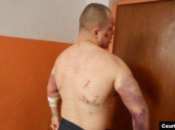 «Душили и вставляли иглы под ногти»: в Запорожье надзиратели годами пытали узников