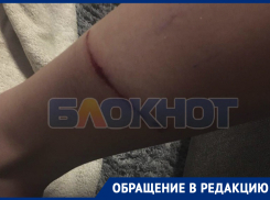 Появилось фото жуткого последствия нападения бездомных псов на жительницу Днепрорудного
