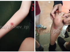 Двое детей попали в больницу после жестокого нападения собак в Запорожье