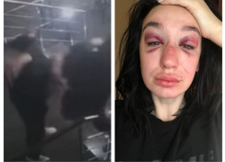 Предлагал ей деньги: раскрыты подробности избиения девушки в запорожском баре