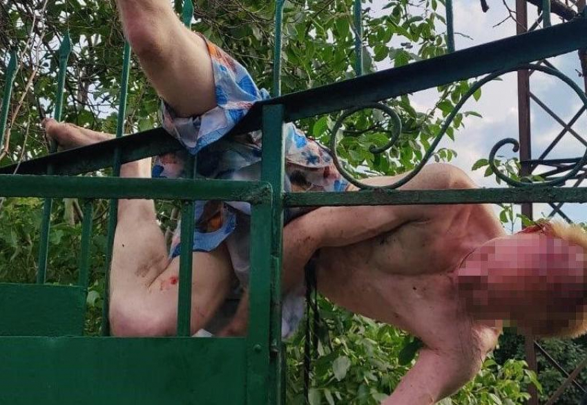 Мужчина в Запорожье насадился на пику металлического забора и провисел вниз головой два часа