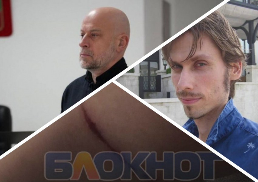 Новости Запорожья: собаки изувечили девушку, предсказание пророка и коррупционный скандал